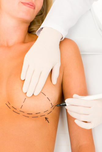 Fix Tuberous Breasts, Cosmetic Surgery